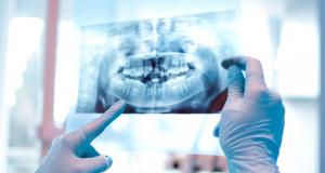 Radiografia dentara poate fi periculoasa?