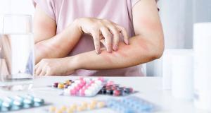 Alergiile la medicamente