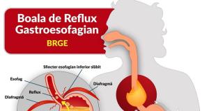 Refluxul gastric si boala de reflux