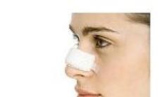 Proceduri cosmetice: operatia nasului (rinoplastia)