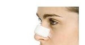 Proceduri cosmetice: operatia nasului (rinoplastia)