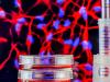 Recoltarea celulelor stem la nastere: oportunitate biologica pentru sanatatea copilului