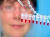 Test revolutionar de sange care detecteaza toate tipurile de cancer