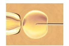 Transferul de blastocisti – Fertilizarea in vitro