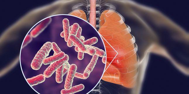 Diagnosticul si evaluarea terapiei in meningita tuberculoasa