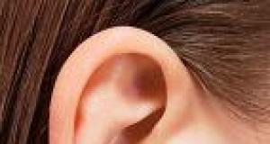 Urechile: ingrijirea si prevenirea afectiunilor frecvente