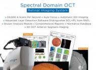 TOMOGRAF  IN  COERENTA OPTICA – 3D OCT
