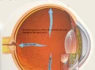 RETINOFOTOGRAF 3D OCT ( FUNDUS CAMERA)